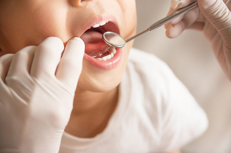 当院の小児歯科の治療